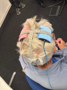 Brain Stimulation at Neurowell